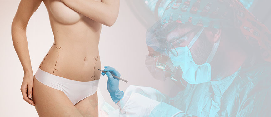 Liposuction tedavi